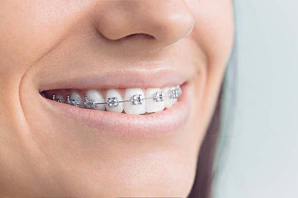 Best Teeth Whitening  in Franklin, TN